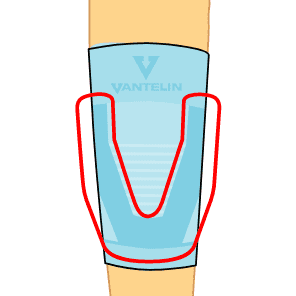 U-Shaped Taping Structure
