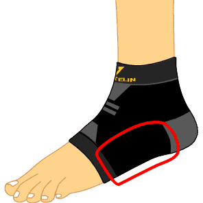 Arch Support Taping Structure