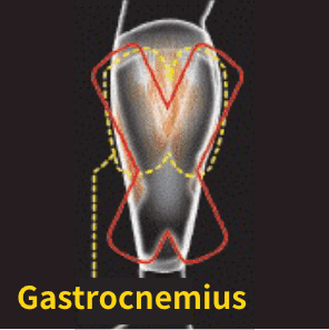 Conditioning Supporte